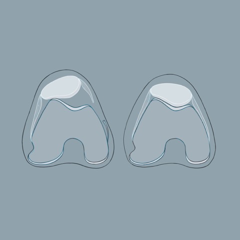 Zeichnung einer Kniescheibe