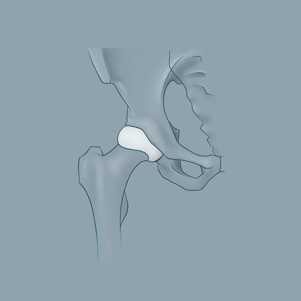 Zeichnung einer gesunden Hüfte