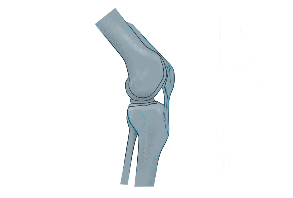 Kniespezialist Wien - Dr Weninger