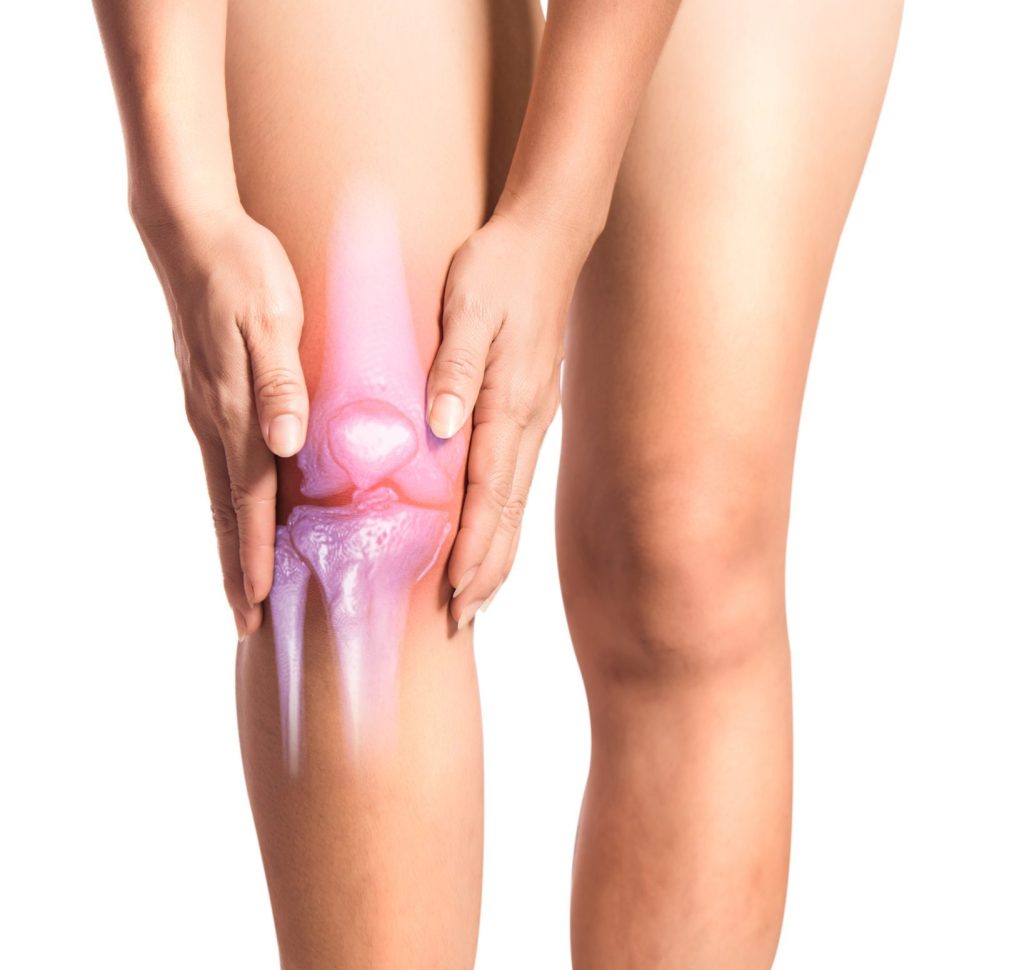Frau greift sich an ihr schmerzendes Knie Meniskusriss - Meniskus OP Wien
