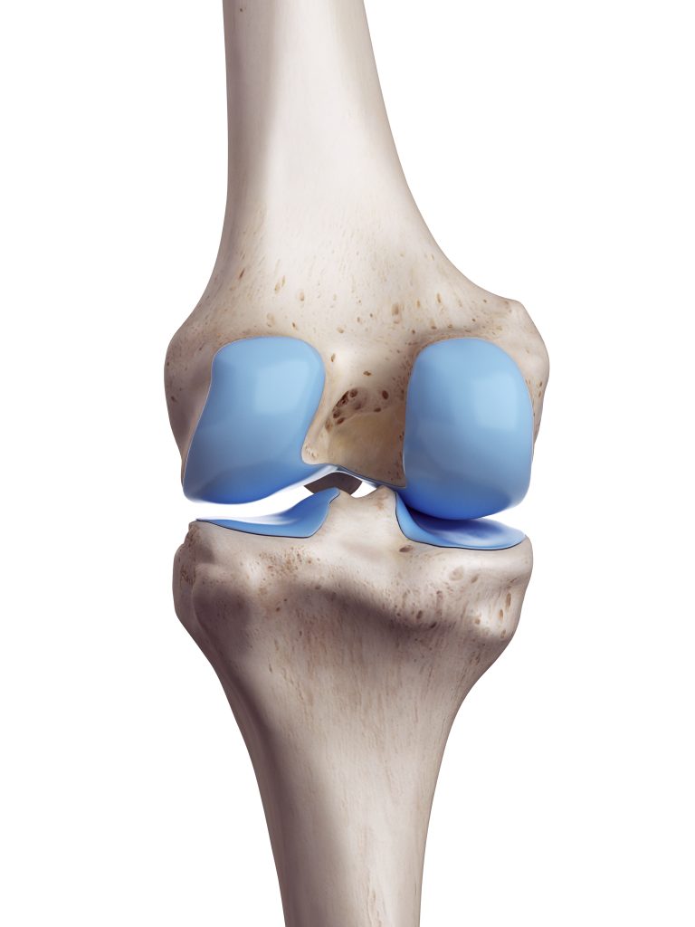 Cartilage Damage Knee Osteoarthritis Treatment Vienna Dr Martin Gruber arthroscopic-ankle-cartilage-repair-new-iberia-la-orthopedic