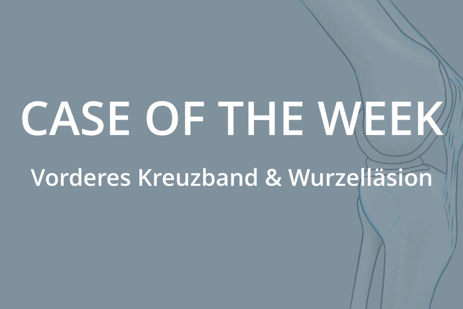 Case of the Week - Verletzung des vordere Kreuzbandes & Wurzelläsion