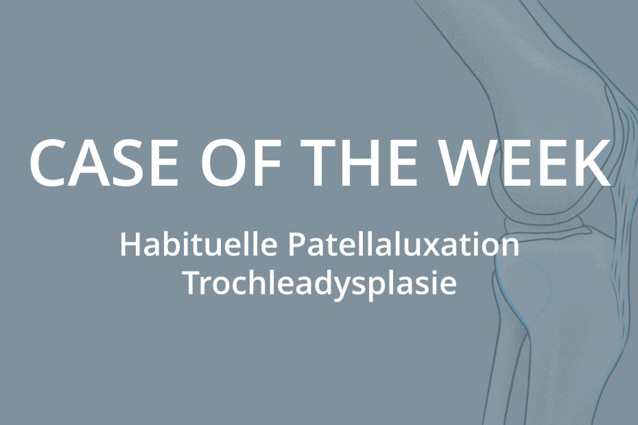 Case of the Week: Habituelle Patellaluxation