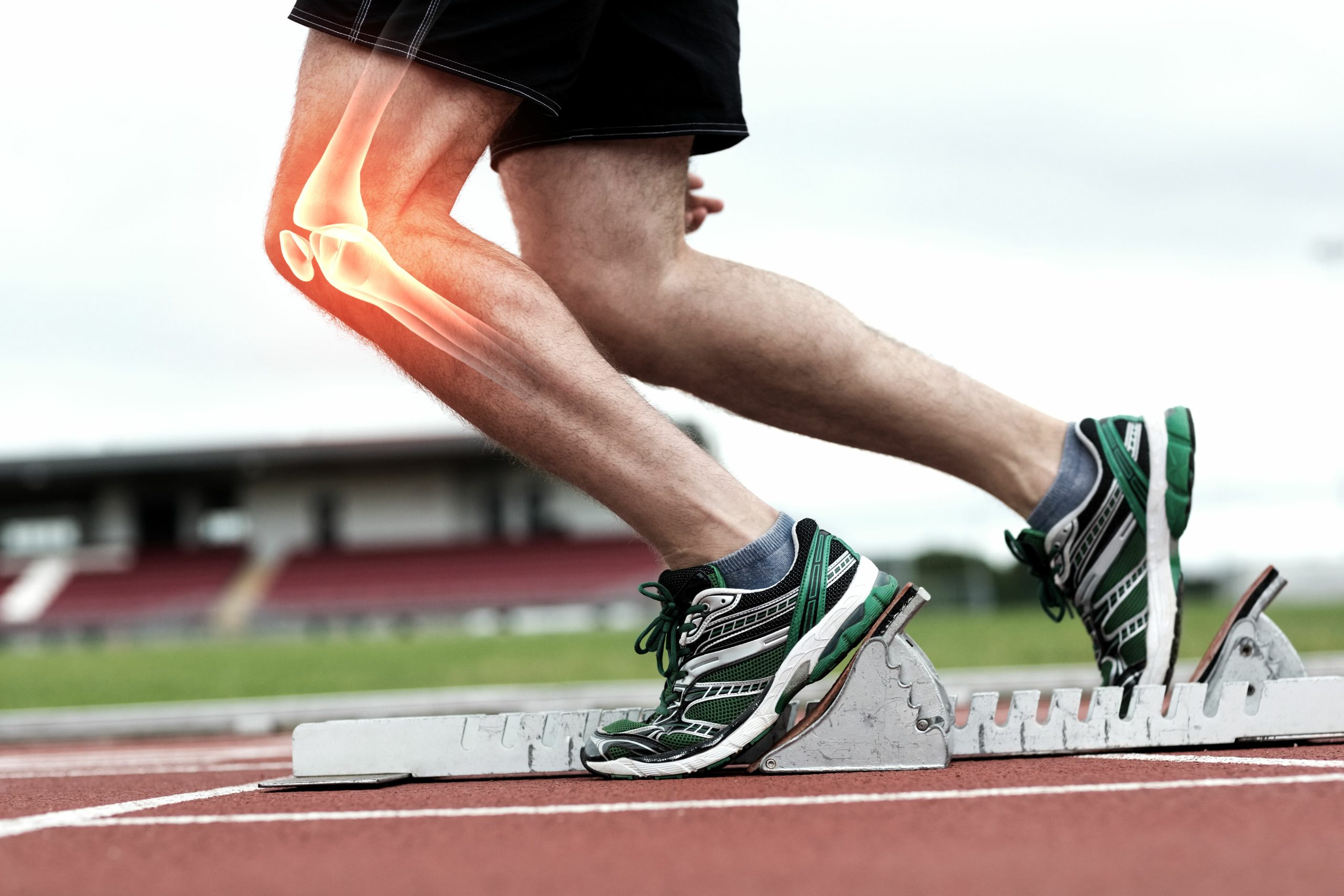 Therapie mit der Hilfe von einem Arzt nach einer Sport-Verletzung um eine Patellaluxation zu heilen und Schmerzen am Bein zu lindern.