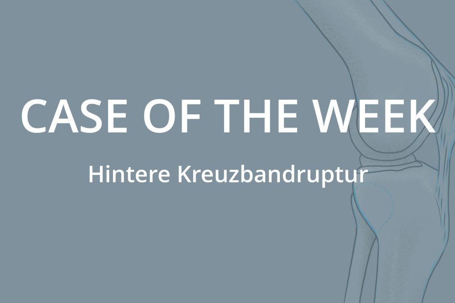 Case of the Week: Hintere Kreuzbandruptur