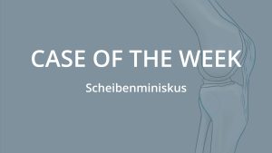Case of the Week: Zyklopssyndrom