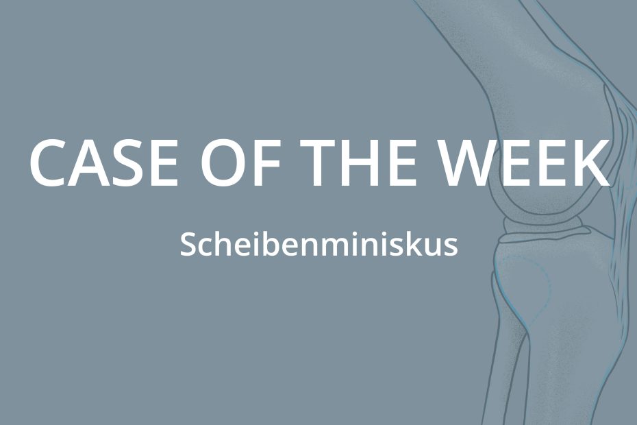 Case of the Week: Zyklopssyndrom