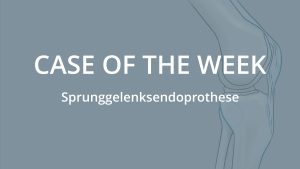 Case of the Week: Stressfraktur
