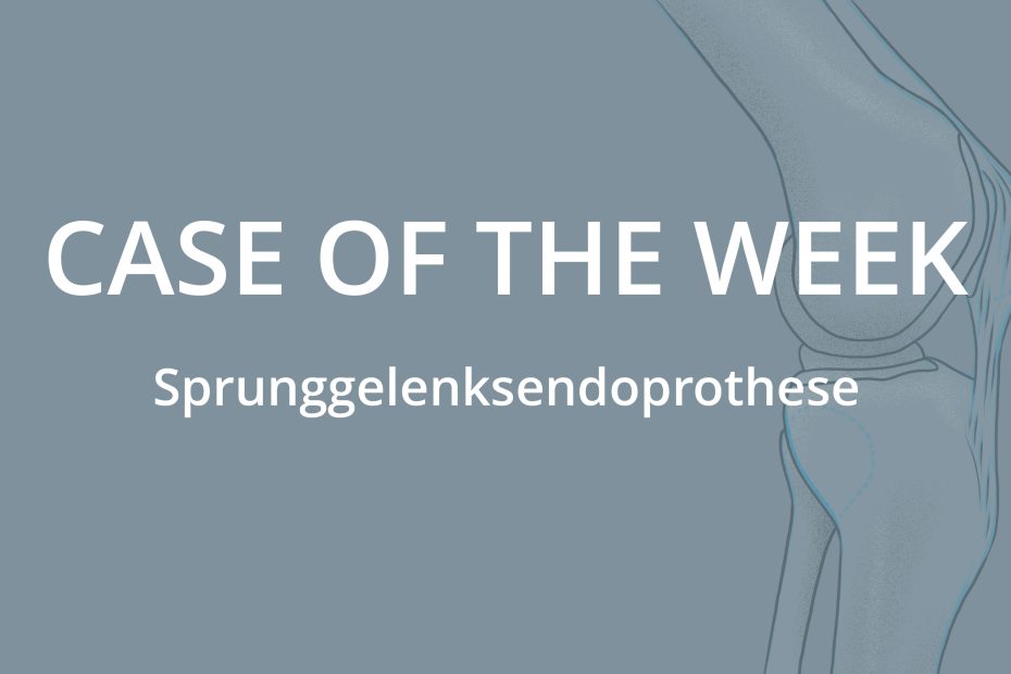 Case of the Week: Stressfraktur