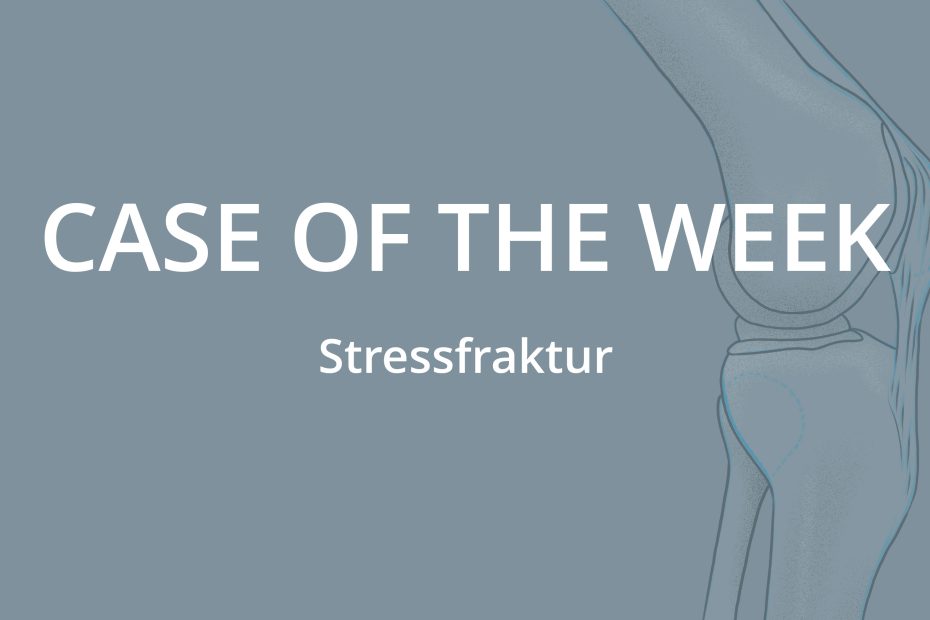Case of the Week: Stressfraktur