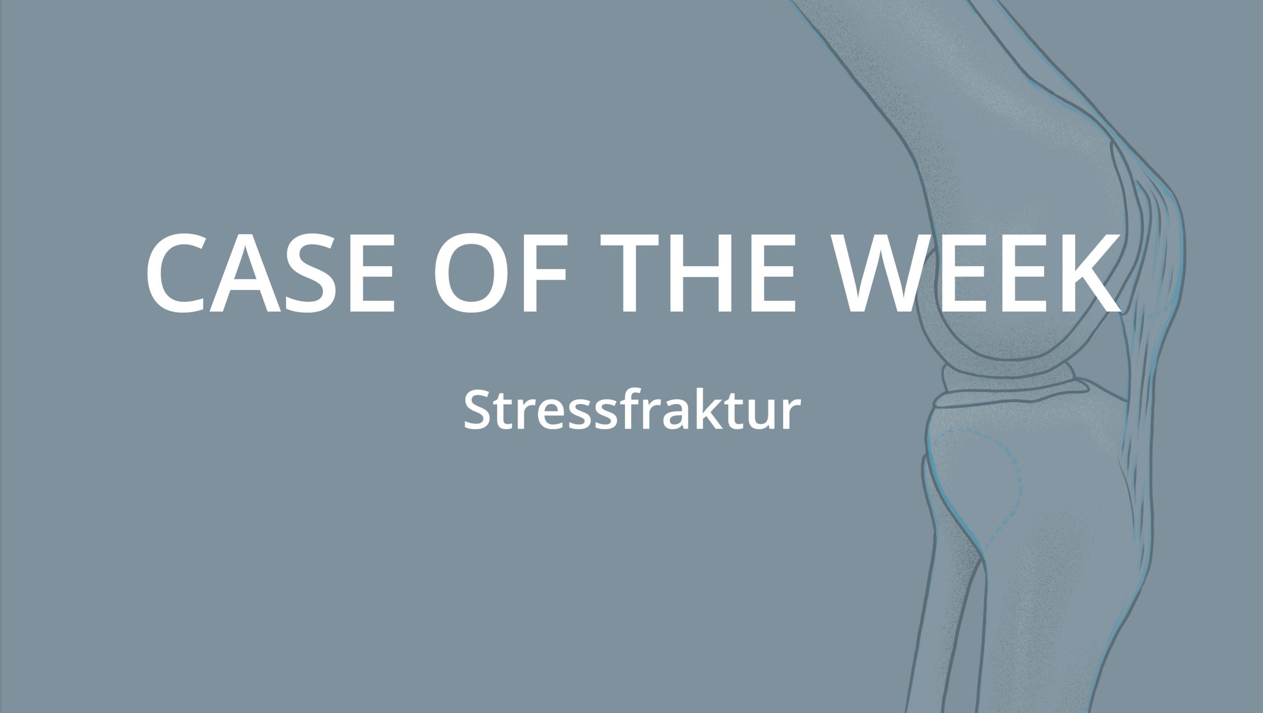 Stressfraktur | Orthopäde Wien