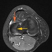 Case of the Week: Scheibenminiskus