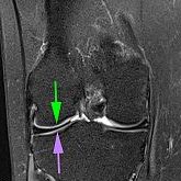 Case of the Week: Scheibenminiskus